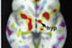Petbrainsmall