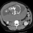 Appendix Rn 2001 01 15 Small