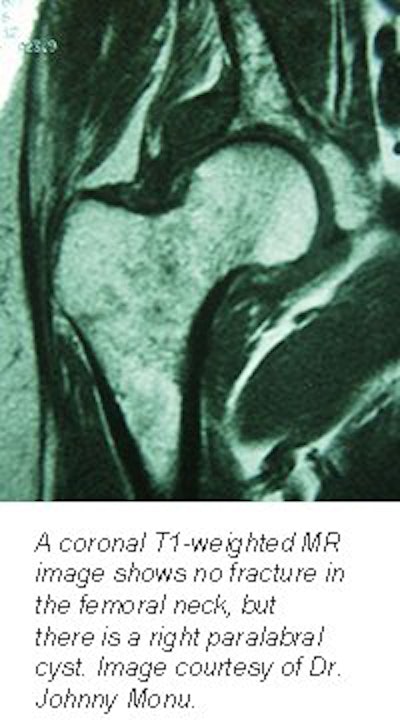 2001 04 04 14 32 37 706