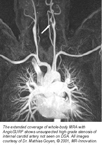 2001 04 10 16 44 06 706