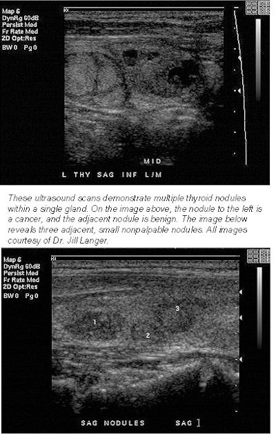 2001 04 17 09 38 28 706