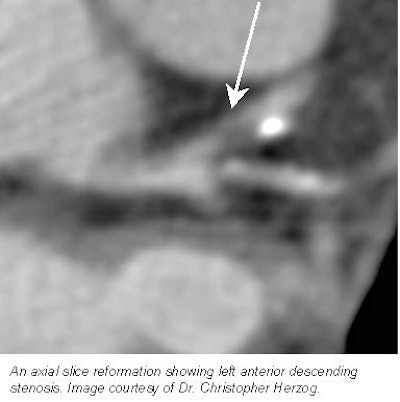 2001 04 18 15 10 55 706