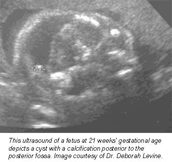 2001 04 24 13 56 12 706