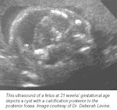 2001 04 24 13 56 12 706