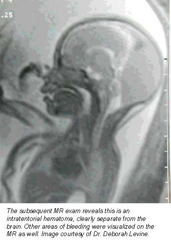 2001 04 24 14 07 58 706