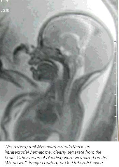 2001 04 24 14 07 58 706