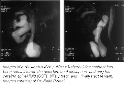 2001 04 25 15 17 23 706