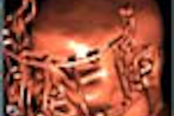 2001 05 11 13 59 35 706