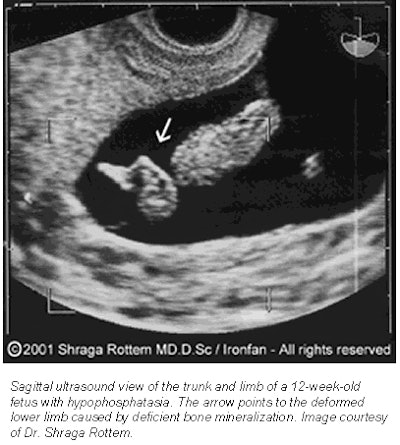 2001 06 11 11 01 24 706