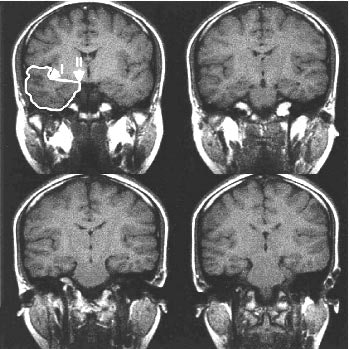 2001 06 21 12 59 58 706