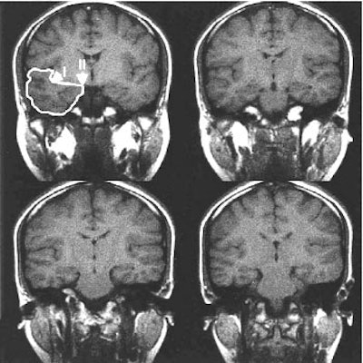 2001 06 21 12 59 58 706