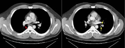 08290111234735 Normal Hila S