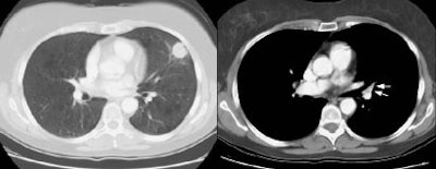 08290111234853 N1 New Criterion S