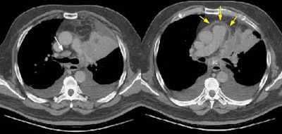 0829011123567 Pericardium S