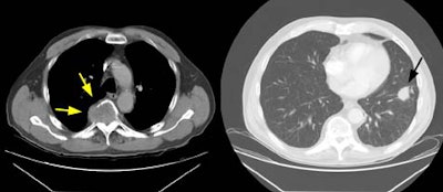 08290111240381 Skip Met To Spine