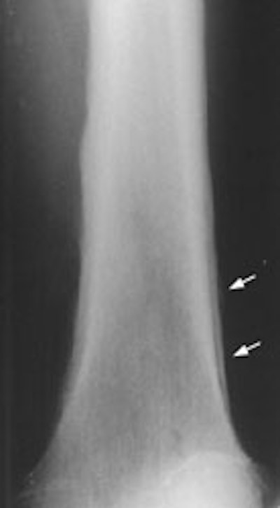 08290111240572 Hoa Plain Film S