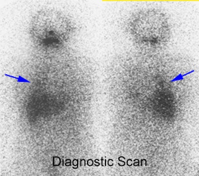 早割航空券 for I-131 thyroid AuntMinnie | discussion cancer 洋書、外国語書籍