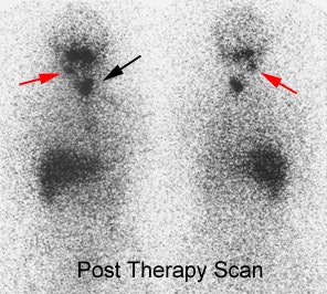 08290111241523 Morelesions Post