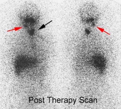 08290111241523 Morelesions Post