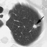 08290111241946 Spnct1