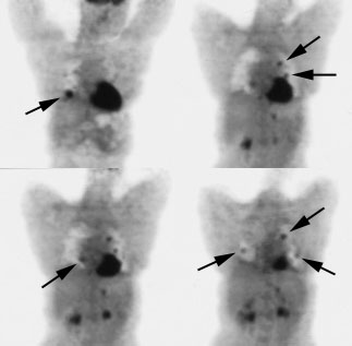 08290111242334 Hurthle Pet