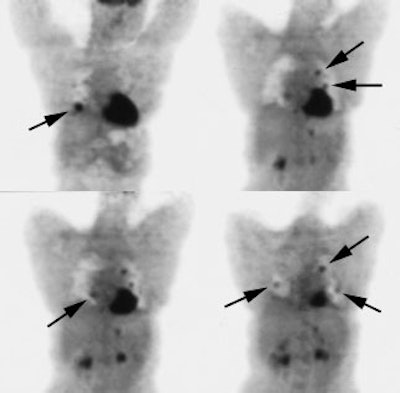 08290111242334 Hurthle Pet