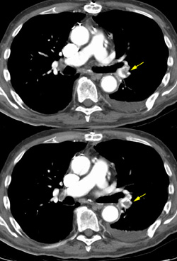 0829011124332 Pe Small