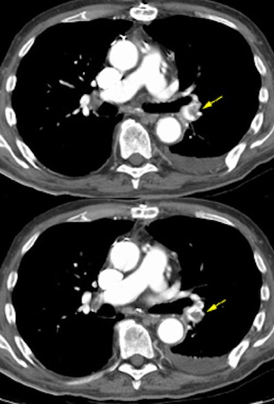 0829011124332 Pe Small