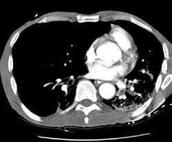 0829011124415 Ct Soft