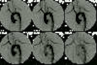 08290111245752agram1a