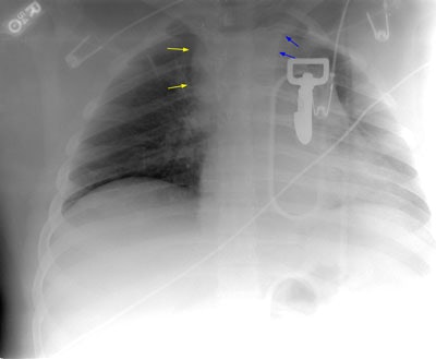 08290111250379 Pa Med