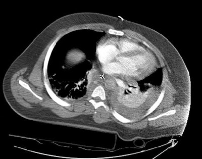 08290111250650 Isthmus2