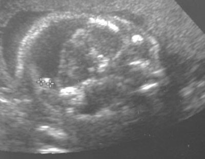 2001 07 18 11 59 11 706