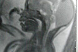 2001 07 18 11 59 35 706