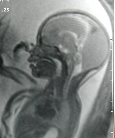 2001 07 18 11 59 35 706