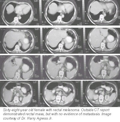 2001 08 09 14 33 15 706