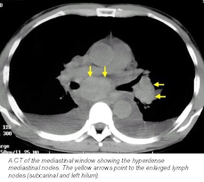 2001 10 29 15 51 39 706