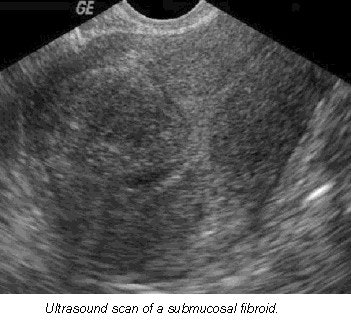 2001 11 12 10 35 07 706