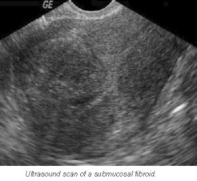 2001 11 12 10 35 07 706