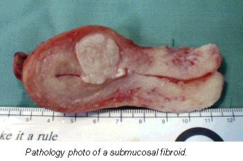 2001 11 12 10 38 33 706