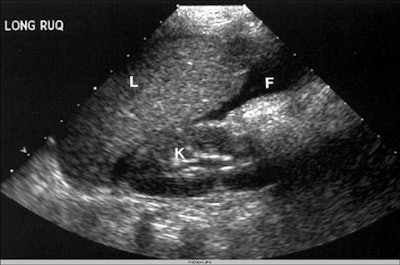 2001 12 13 15 45 57 706