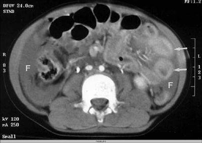 2001 12 13 15 46 36 706