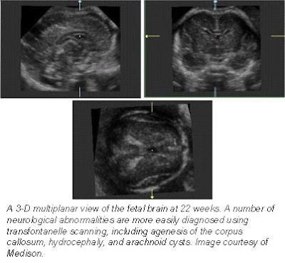 2001 12 17 15 30 33 706