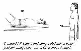 Lower Rib Ap Position AP abdominal projection x-ray positioning techniques | AuntMinnie