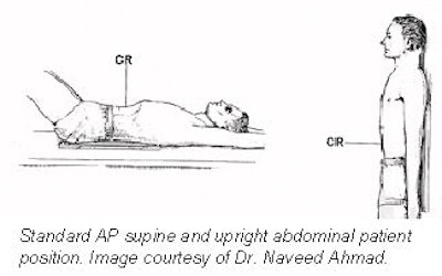 Patient setup with the abdominal compression device (a) located in the
