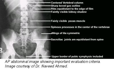 Upper Limbs  Radiology Key