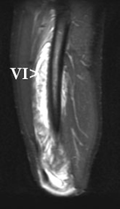 2002 02 13 16 32 08 706