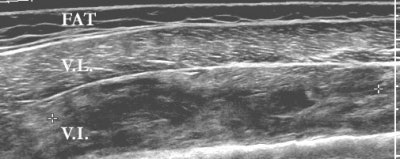 2002 02 13 16 32 32 706