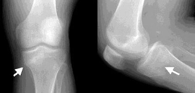 2002 02 13 17 15 16 706