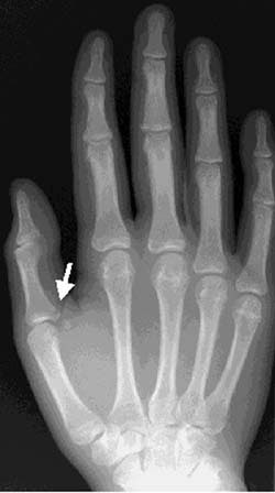 2002 02 14 17 55 50 706